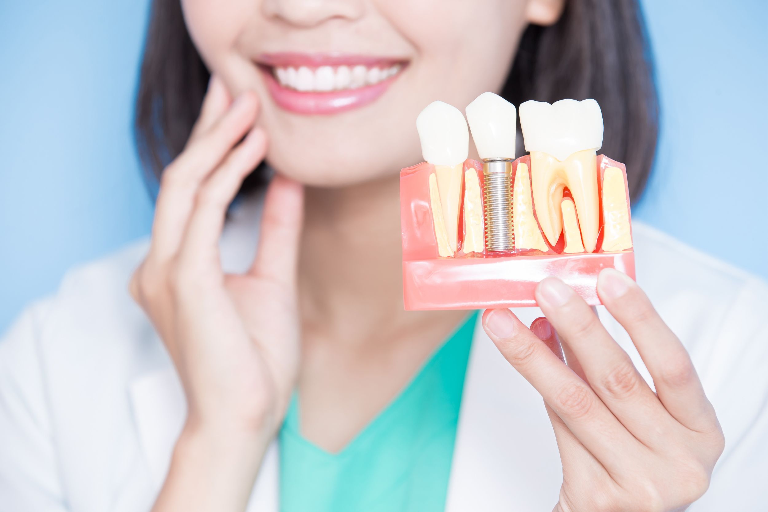 Dental implants and implant-supported tooth model at Ansarian Dental Clinic