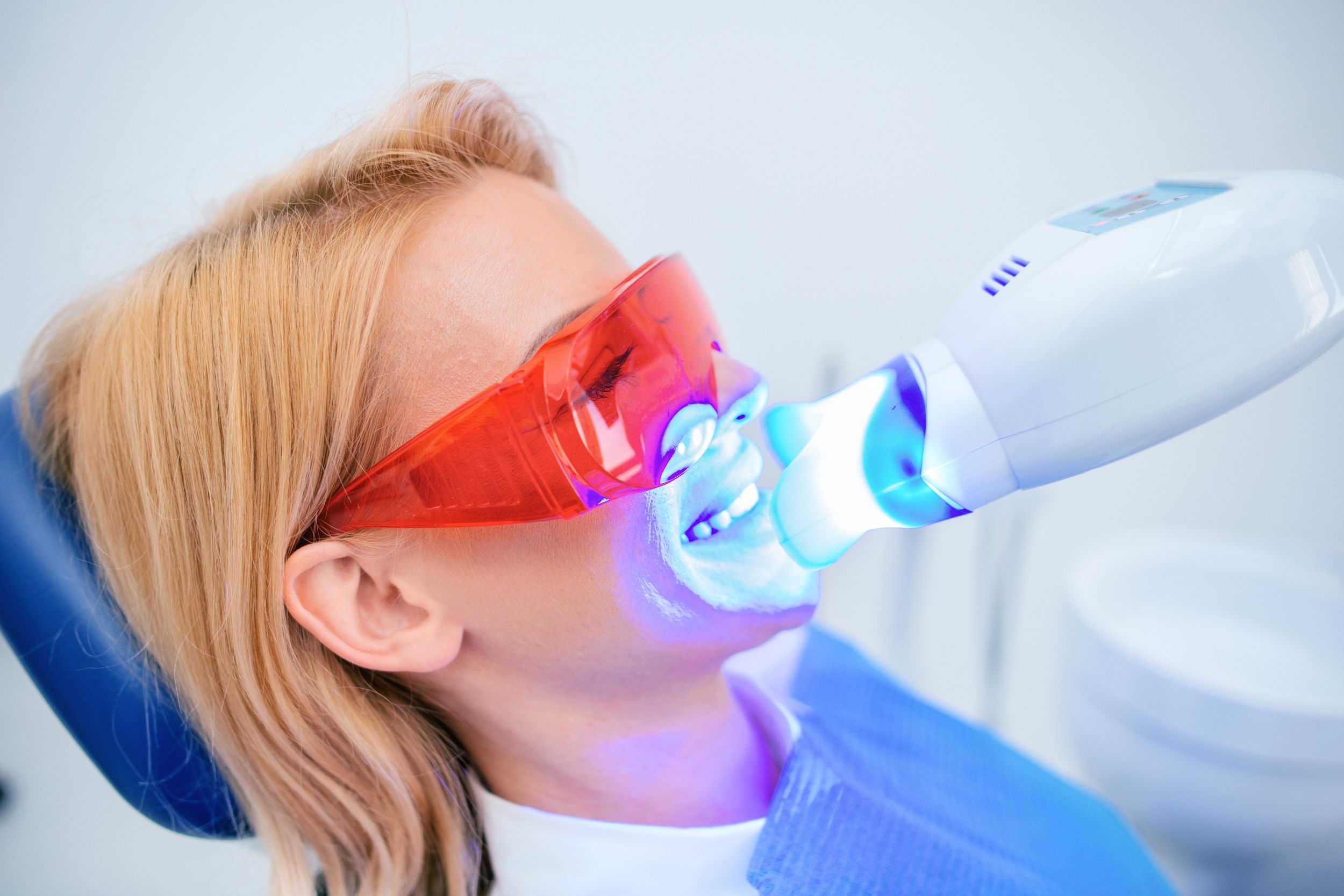 Professional teeth whitening in Toronto at Ansarian Dental Clinic