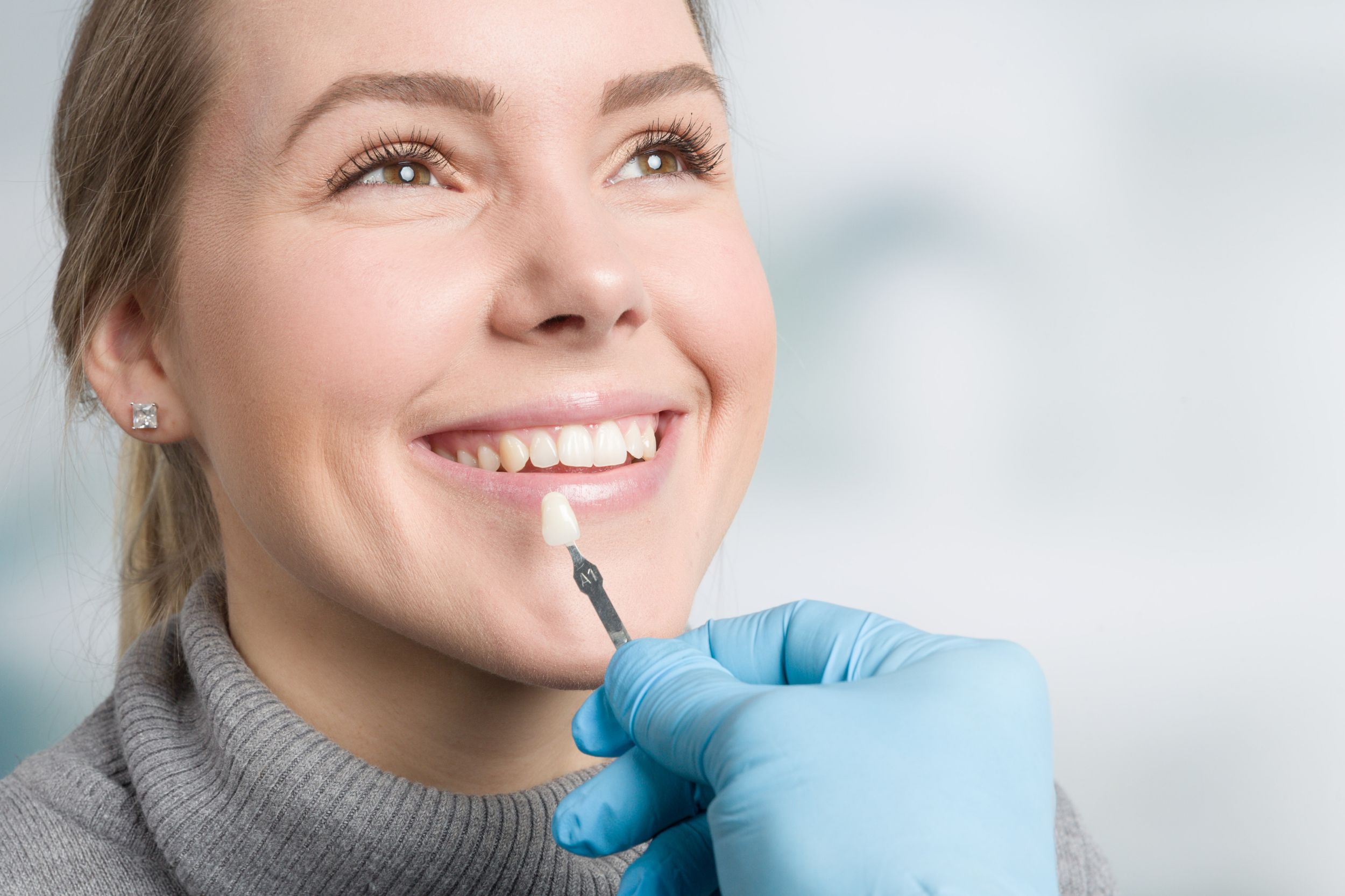 Dental veneers in Toronto at Ansarian Dental Clinic